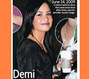 Is Demi Lovato Cutting Again? - Sponkit Celebrity Blog