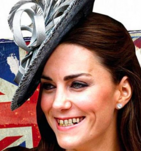 Duchess Kate, Duchess of Cambridge, kate middleton teeth, kate middleton rotten, kate middleton controversy,